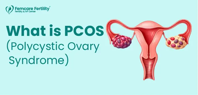 know about PCOS