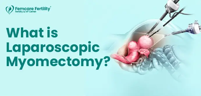 know about laparoscopy myomectomy