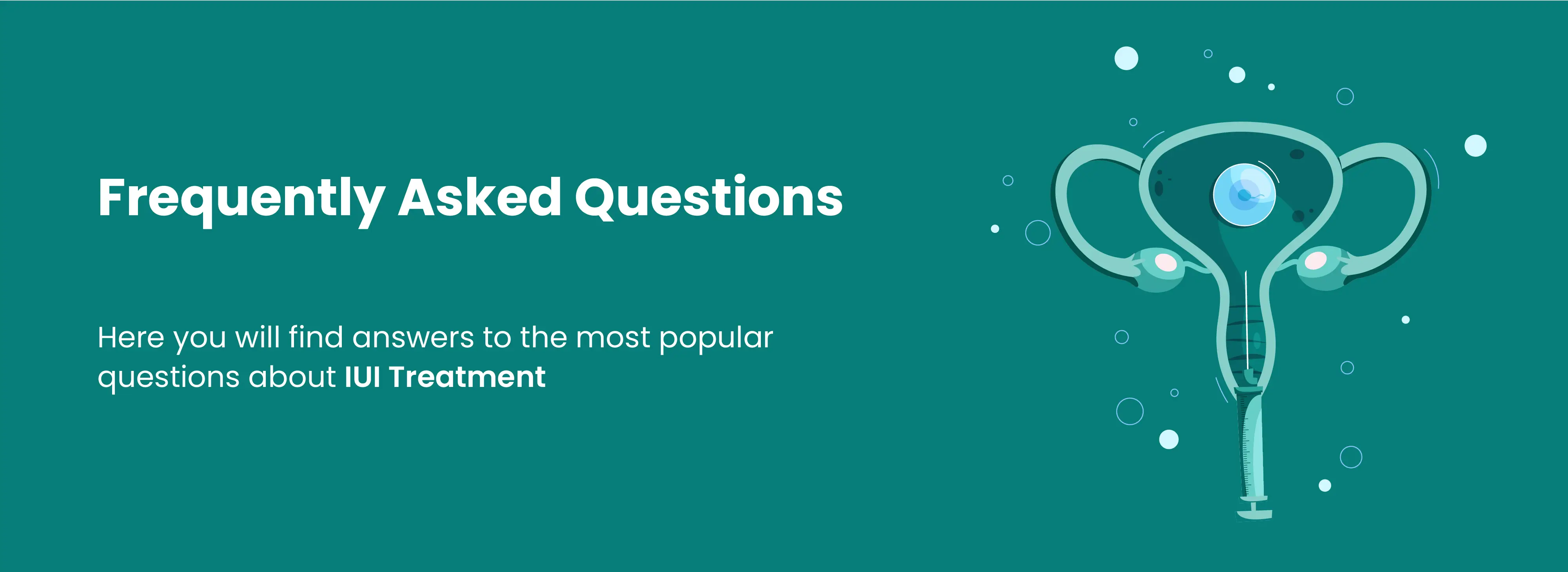 FAQs about IUI treatment